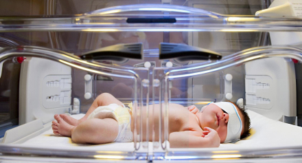 Image representing Newborn Jaundice: Diagnosis, Treatment, and Long-Term Implications