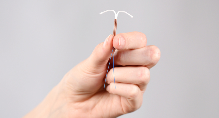 Image representing The Copper T: A Comprehensive Guide to This Hormone-Free Birth Control Option